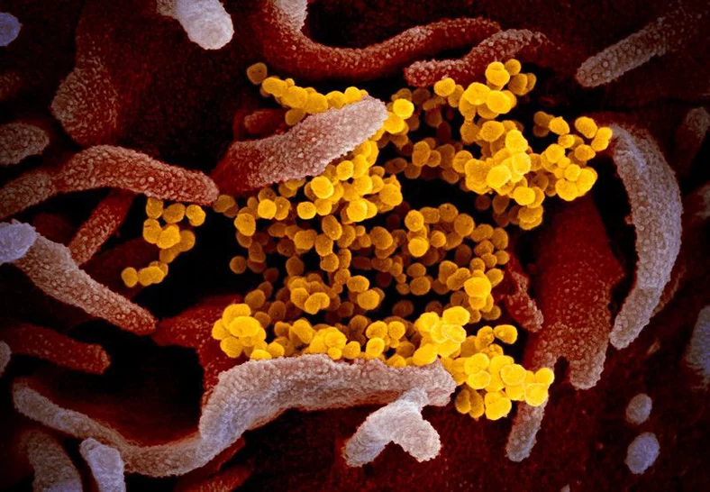 Koronavirüsün elektron mikroskobu altındaki yeni görüntüsü yayımlandı
