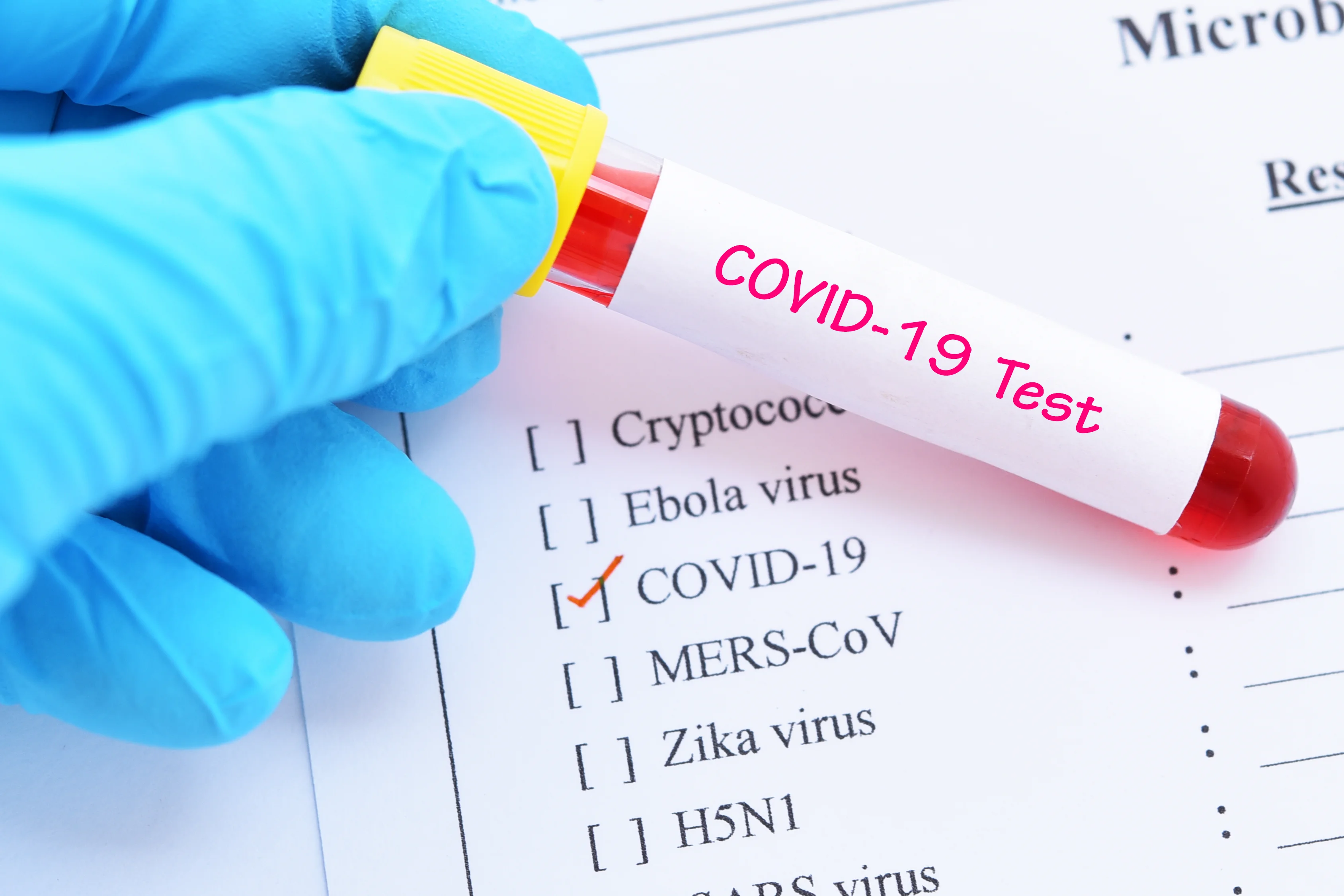 Test kriterleri değişiyor: Sağlıklı kişilere de Kovid-19 testi yapılacak
