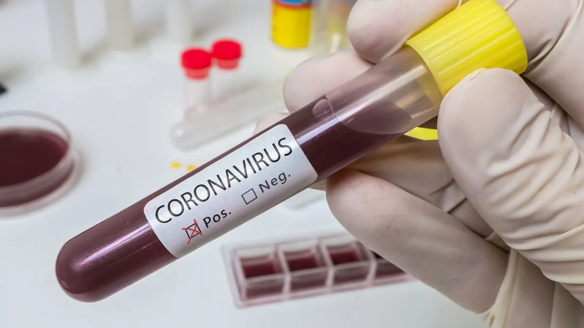 Uzun bir aradan sonra kentte koronavirüs vakası: Vali sebebini açıkladı