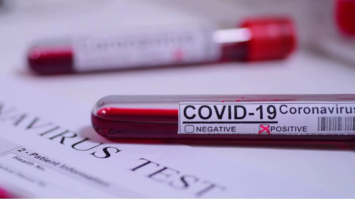 Güreş Milli Takımı'nda 13'ü sporcu toplam 15 kişinin koronavirüs testi pozitif çıktı
